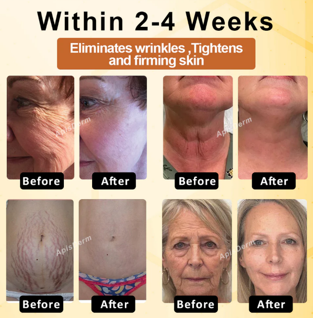 BotoxBee Advanced Multi-Action FirmingCream