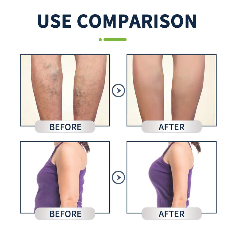 Limpeza Gel Natural Herbal Emagrecimento Pé Soak